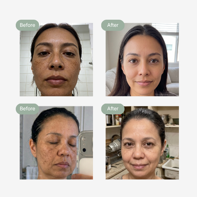 Verena™ Korean Brightening Cream